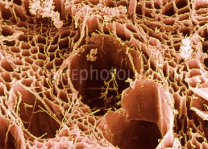 B2501509-Rotten_wood2C_SEM-SPL