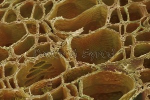 myrica-bog-myrtle-xylem--myrica-gale--80018924-l